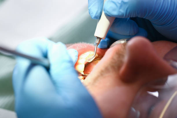 Best Emergency Dental Care for Trauma or Injury in Baldwyn, MS