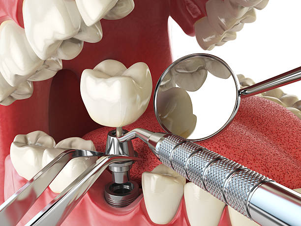 Best Emergency Treatment for Toothache in Baldwyn, MS